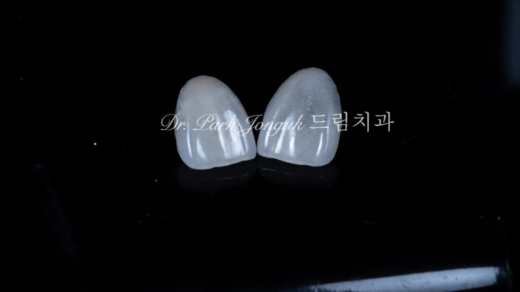 자연스러운 라미네이트