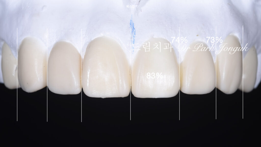 강남 토끼이 라미네이트 잘하는곳
