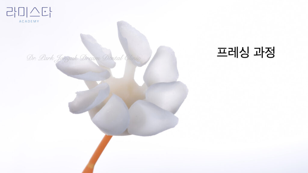 라미네이트 제작 방법, Laminate Fabrication Methods, 수작업 빌드업, Hand-Layered Build-up, CAD/CAM 밀링, CAD/CAM Milling, E-max 베이스, E-max Base, 자연스러운 라미네이트, Natural Laminate