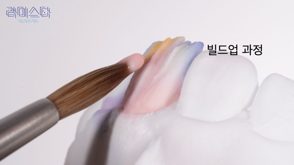 앞니 라미네이트, Anterior Laminate, 라미네이트 티 나요, Artificial Laminate, 자연스러운 라미네이트, Natural Laminate, 라인 앵글, Line Angles, 발육엽, Developmental Lobes, 핸드메이드 빌드업, Hand-Layered Build-up