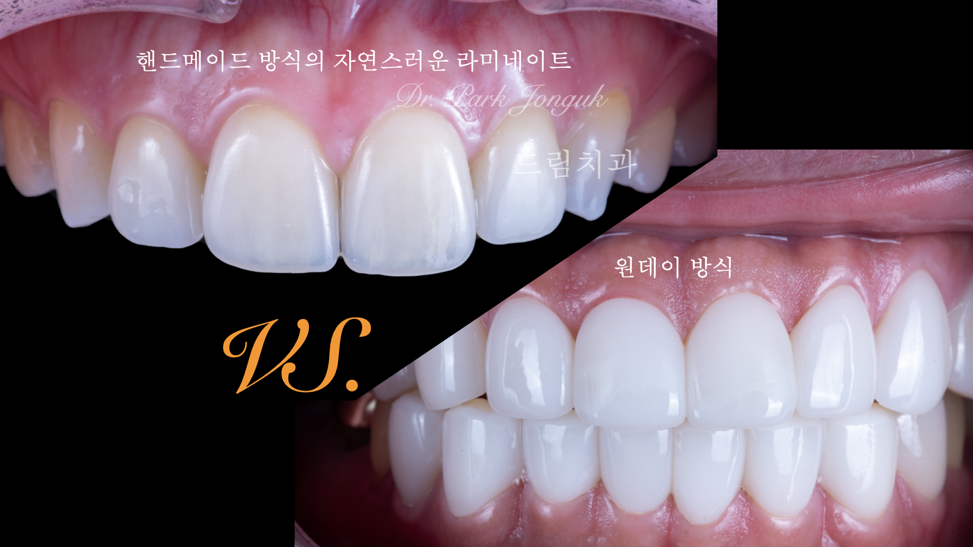 투명한 라미네이트촤 불투명하고어색한 라미네이트