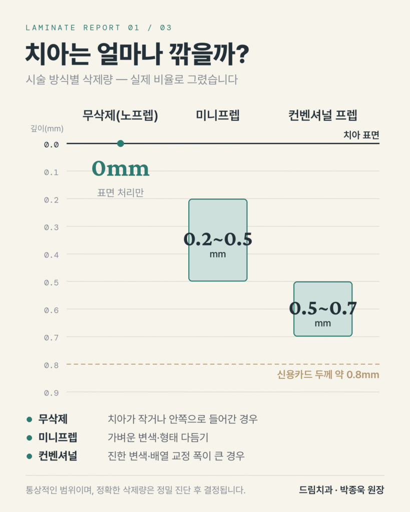 라미네이트를 위한 치아 삭제량