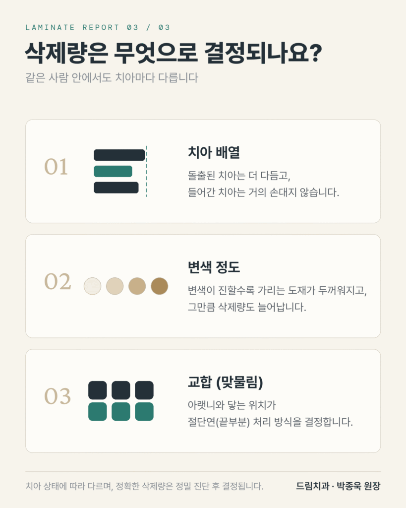 라미네이트 삭제의 기준
